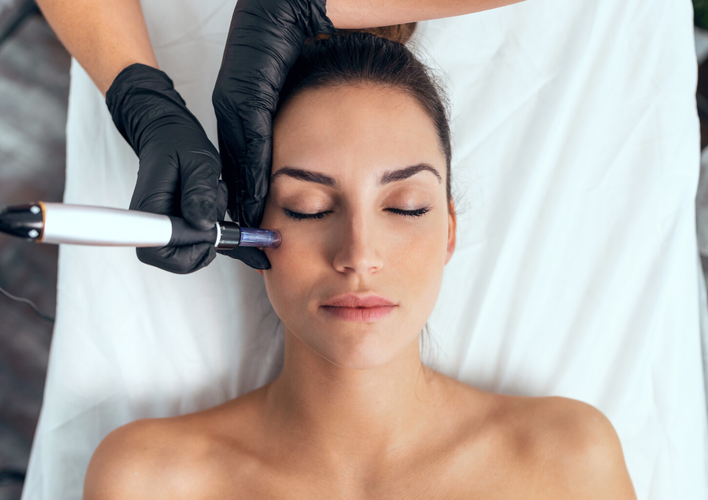 Mezoterapia Mikroigłowa "DermaPen Vitamin Shot" | Katowice