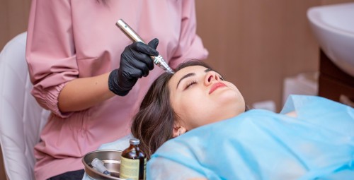 Infuzja Tlenowa Skóry Głowy | Toruń-Prezent na Imieniny_P