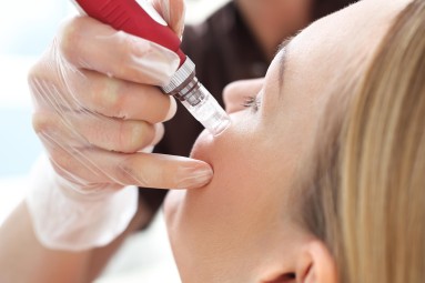 Nawilżająca Mezoterapia Mikroigłowa | Bytom-Prezent dla Żony_S