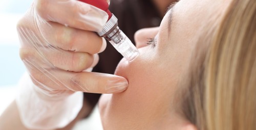 Nawilżająca Mezoterapia Mikroigłowa | Bytom-Prezent dla Żony_S