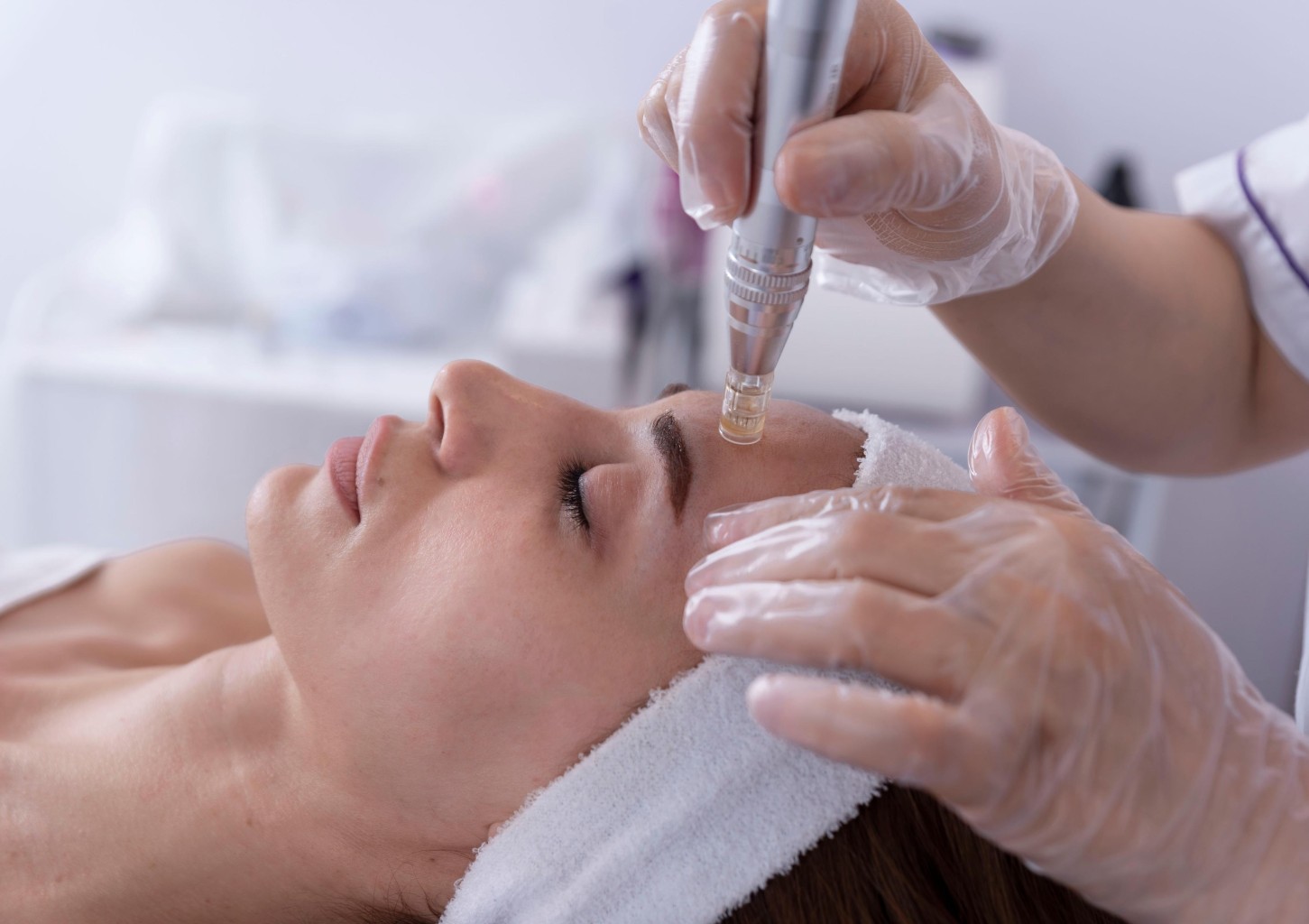 Nawilżająca Mezoterapia Mikroigłowa | Bytom