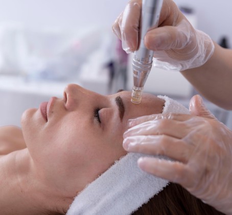 Nawilżająca Mezoterapia Mikroigłowa | Bytom