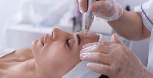 Nawilżająca Mezoterapia Mikroigłowa | Bytom-Prezent na Urodziny_S