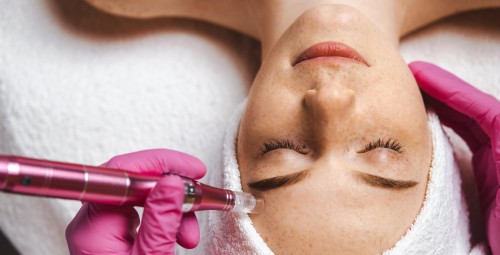 Nawilżająca Mezoterapia Mikroigłowa | Bytom-Prezent dla Ukochanej_S